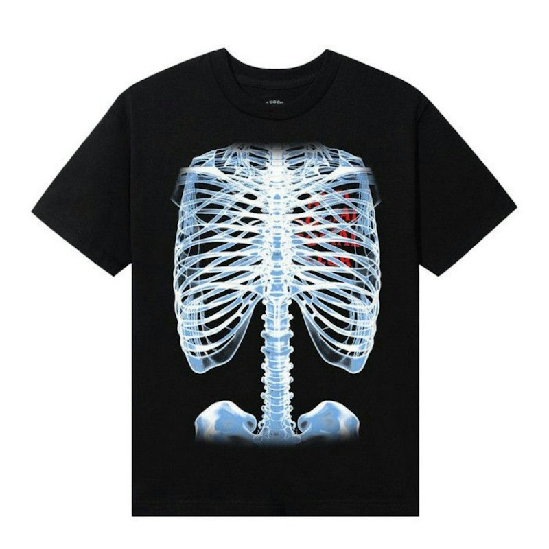Anti Social Social Club Bones Tee Black